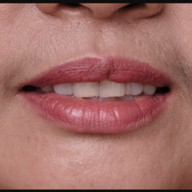 The Portrait Masters – The Retouching Series: Lip Hair Mustache  (Premium)